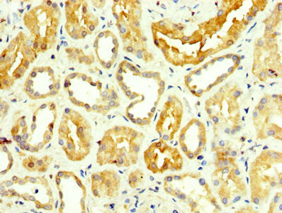 IHC image of the antibody diluted at 1:350 and staining in paraffin-embedded human kidney tissue performed on a Leica BondTM system. After dewaxing and hydration, antigen retrieval was mediated by high pressure in a citrate buffer (pH 6.0). Section was blocked with 10% normal goat serum 30min at RT. Then primary antibody (1% BSA) was incubated at 4°C overnight. The primary is detected by a biotinylated secondary antibody and visualized using an HRP conjugated SP system.Rabbit anti-Human GPT Polyclonal Antibody