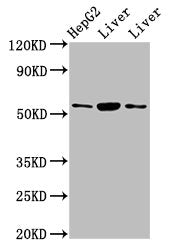 Western Blot  | Positive WB detected in: HepG2 whole cell lysate, Rat liver tissue, Mouse liver tissue  | All lanes: GPT antibody at 4.5µg/ml  | Secondary  | Goat polyclonal to rabbit IgG at 1/50000 dilution  | Predicted band size: 55 kDa  | Observed band size: 55 kDaRabbit anti-Human GPT Polyclonal Antibody