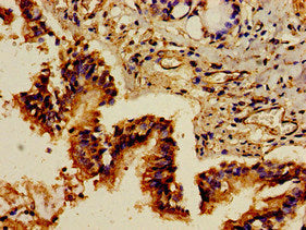 Immunohistochemistry of paraffin-embedded human lung tissue using GRB10 Antibody at dilution of 1:100Rabbit anti-Human GRB10 Polyclonal Antibody