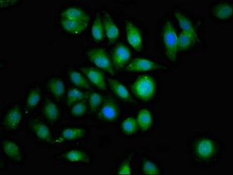 Immunofluorescence staining of A549 cells with GRB14 Antibody at 1:100, counter-stained with DAPI. The cells were fixed in 4% formaldehyde, permeabilized using 0.2% Triton X-100 and blocked in 10% normal Goat Serum. The cells were then incubated with the antibody overnight at 4°C. The secondary antibody was Alexa Fluor 488-congugated AffiniPure Goat Anti-Rabbit IgG(H+L).Rabbit anti-Human GRB14 Polyclonal Antibody