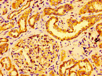 IHC image of GRB14 Antibody diluted at 1:100 and staining in paraffin-embedded human kidney tissue performed on a Leica BondTM system. After dewaxing and hydration, antigen retrieval was mediated by high pressure in a citrate buffer (pH 6.0). Section was blocked with 10% normal goat serum 30min at RT. Then primary antibody (1% BSA) was incubated at 4°C overnight. The primary is detected by a biotinylated secondary antibody and visualized using an HRP conjugated SP system.Rabbit anti-Human GRB14 Polyclonal Antibody
