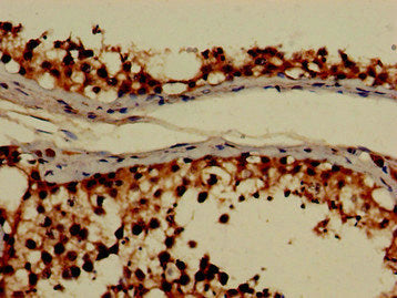 Immunohistochemistry of paraffin-embedded human testis tissue using GRHPR Antibody at dilution of 1:100Rabbit anti-Human GRHPR Polyclonal Antibody