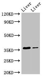 Western Blot | Positive WB detected in: Rat liver tissue, Mouse liver tissue | All lanes: GRHPR antibody at 3.5μg/ml | Secondary | Goat polyclonal to rabbit IgG at 1/50000 dilution | Predicted band size: 36, 28 kDa | Observed band size: 36 kDaRabbit anti-Human GRHPR Polyclonal Antibody