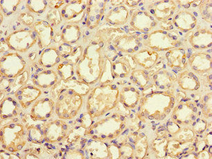 Immunohistochemistry of paraffin-embedded human kidney tissue using the antibody at dilution of 1:100Rabbit anti-Human GRID2IP Polyclonal Antibody