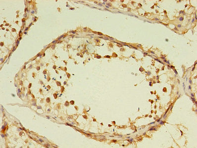 Immunohistochemistry of paraffin-embedded human testis tissue using GRK4 Antibody at dilution of 1:100