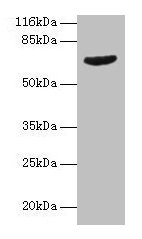 Western blot  | All lanes: GRK4 antibody at 2µg/ml + Jurkat whole cell lysate  | Secondary  | Goat polyclonal to rabbit IgG at 1/10000 dilution  | Predicted band size: 67, 64, 58, 62 kDa  | Observed band size: 67 kDa