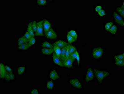 Immunofluorescence staining of HepG2 cells with GRK5 Antibody at 1:166, counter-stained with DAPI. The cells were fixed in 4% formaldehyde, permeabilized using 0.2% Triton X-100 and blocked in 10% normal Goat Serum. The cells were then incubated with the antibody overnight at 4°C. The secondary antibody was Alexa Fluor 488-congugated AffiniPure Goat Anti-Rabbit IgG(H+L).Rabbit anti-Human GRK5 Polyclonal Antibody