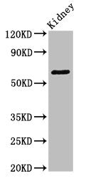 Western Blot | Positive WB detected in: Mouse kidney tissue | All lanes: GRK5 antibody at 3.4μg/ml | Secondary | Goat polyclonal to rabbit IgG at 1/50000 dilution | Predicted band size: 68 kDa | Observed band size: 68 kDaRabbit anti-Human GRK5 Polyclonal Antibody