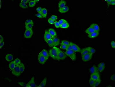 Immunofluorescence staining of PC-3 cells with GRPR Antibody at 1:100, counter-stained with DAPI. The cells were fixed in 4% formaldehyde, permeabilized using 0.2% Triton X-100 and blocked in 10% normal Goat Serum. The cells were then incubated with the antibody overnight at 4°C. The secondary antibody was Alexa Fluor 488-congugated AffiniPure Goat Anti-Rabbit IgG(H+L).Rabbit anti-Human GRPR Polyclonal Antibody
