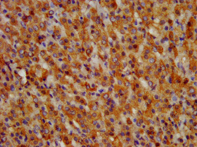 IHC image of the antibody diluted at 1:300 and staining in paraffin-embedded human adrenal gland tissue performed on a Leica BondTM system. After dewaxing and hydration, antigen retrieval was mediated by high pressure in a citrate buffer (pH 6.0). Section was blocked with 10% normal goat serum 30min at RT. Then primary antibody (1% BSA) was incubated at 4°C overnight. The primary is detected by a biotinylated secondary antibody and visualized using an HRP conjugated SP system.Rabbit anti-Human GRPR Polyclonal Antibody