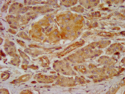 IHC image of GRPR Antibody diluted at 1:300 and staining in paraffin-embedded human pancreatic tissue performed on a Leica BondTM system. After dewaxing and hydration, antigen retrieval was mediated by high pressure in a citrate buffer (pH 6.0). Section was blocked with 10% normal goat serum 30min at RT. Then primary antibody (1% BSA) was incubated at 4°C overnight. The primary is detected by a biotinylated secondary antibody and visualized using an HRP conjugated SP system.Rabbit anti-Human GRPR Polyclonal Antibody