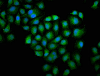Immunofluorescence staining of Hela cells with the antibody at 1:100, counter-stained with DAPI. The cells were fixed in 4% formaldehyde, permeabilized using 0.2% Triton X-100 and blocked in 10% normal Goat Serum. The cells were then incubated with the antibody overnight at 4°C. The secondary antibody was Alexa Fluor 488-congugated AffiniPure Goat Anti-Rabbit IgG(H+L).Rabbit anti-Human GSN Polyclonal Antibody