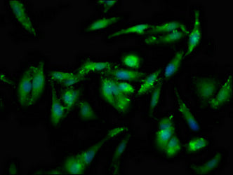 Immunofluorescence staining of Hela cells with GSPT1 Antibody at 1:133, counter-stained with DAPI. The cells were fixed in 4% formaldehyde, permeabilized using 0.2% Triton X-100 and blocked in 10% normal Goat Serum. The cells were then incubated with the antibody overnight at 4°C. The secondary antibody was Alexa Fluor 488-congugated AffiniPure Goat Anti-Rabbit IgG(H+L).Rabbit anti-Human GSPT1 Polyclonal Antibody