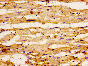 IHC image of GSPT1 Antibody diluted at 1:400 and staining in paraffin-embedded human heart tissue performed on a Leica BondTM system. After dewaxing and hydration, antigen retrieval was mediated by high pressure in a citrate buffer (pH 6.0). Section was blocked with 10% normal goat serum 30min at RT. Then primary antibody (1% BSA) was incubated at 4°C overnight. The primary is detected by a biotinylated secondary antibody and visualized using an HRP conjugated ABC system.Rabbit anti-Human GSPT1 Polyclonal Antibody