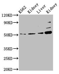 Western Blot  | Positive WB detected in: K562 whole cell lysate, Rat kidney tissue, Mouse liver tissue, Mouse kidney tissue  | All lanes: GSS antibody at 5.1µg/ml  | Secondary  | Goat polyclonal to rabbit IgG at 1/50000 dilution  | Predicted band size: 53, 41 kDa  | Observed band size: 53 kDaRabbit anti-Human GSS Polyclonal Antibody