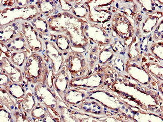 Immunohistochemistry of paraffin-embedded human kidney tissue using GSTA1 Antibody at dilution of 1:100Rabbit anti-Human GSTA1 Polyclonal Antibody