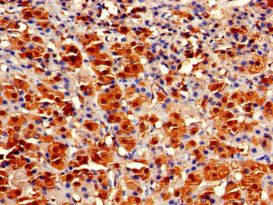 Immunohistochemistry of paraffin-embedded human adrenal gland tissue using GSTA1 Antibody at dilution of 1:100Rabbit anti-Human GSTA1 Polyclonal Antibody