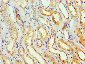 Immunohistochemistry of paraffin-embedded human kidney tissue using GSTA2 Antibody at dilution of 1:100Rabbit anti-Human GSTA2 Polyclonal Antibody