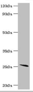 Western blot | All lanes: Glutathione S-transferase A2 antibody at 4μg/ml + Mouse liver tissue | Secondary | Goat polyclonal to rabbit IgG at 1/10000 dilution | Predicted band size: 26 kDa | Observed band size: 26 kDaRabbit anti-Human GSTA2 Polyclonal Antibody