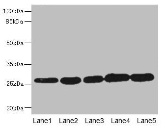 Western blot  | All lanes: GSTK1 antibody at 0.51µg/ml  | Lane 1: MCF-7 whole cell lysate  | Lane 2: K562 whole cell lysate  | Lane 3: Hela whole cell lysate  | Lane 4: HepG2 whole cell lysate  | Lane 5: Raji whole cell lysate  | Secondary  | Goat polyclonal to rabbit IgG at 1/10000 dilution  | Predicted band size: 26, 32, 25, 21 kDa  | Observed band size: 26 kDaRabbit anti-Human GSTK1 Polyclonal Antibody