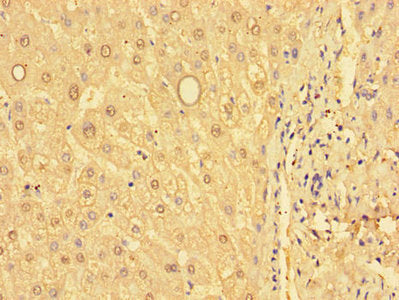 Immunohistochemistry of paraffin-embedded human liver tissue using the antibody at dilution of 1:100Rabbit anti-Human GSTM1 Polyclonal Antibody