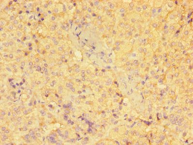 Immunohistochemistry of paraffin-embedded human adrenal gland tissue using GSTM1 Antibody at dilution of 1:100Rabbit anti-Human GSTM1 Polyclonal Antibody