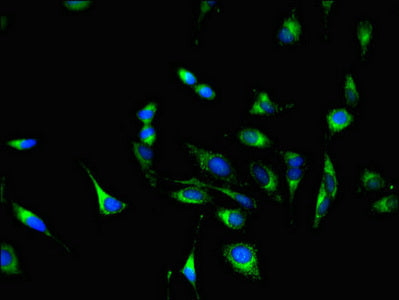 Immunofluorescent analysis of Hela cells using GSTM3 Antibody at dilution of 1:100 and Alexa Fluor 488-congugated AffiniPure Goat Anti-Rabbit IgG(H+L)Rabbit anti-Human GSTM3 Polyclonal Antibody