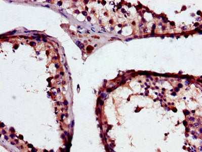 Immunohistochemistry of paraffin-embedded human testis tissue using GSTM3 Antibody at dilution of 1:100Rabbit anti-Human GSTM3 Polyclonal Antibody