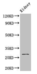 Western Blot | Positive WB detected in: Mouse kidney tissue | All lanes: GSTM3 antibody at 2.8μg/ml | Secondary | Goat polyclonal to rabbit IgG at 1/50000 dilution | Predicted band size: 27 kDa | Observed band size: 27 kDaRabbit anti-Human GSTM3 Polyclonal Antibody