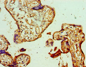 Immunohistochemistry of paraffin-embedded human placenta tissue using GSTM4 Antibody at dilution of 1:100Rabbit anti-Human GSTM4 Polyclonal Antibody
