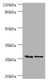 Western blot | All lanes: GSTM4 antibody at 10μg/ml | Lane 1: Rat lung tissue | Lane 2: MCF-7 whole cell lysate | Secondary | Goat polyclonal to rabbit IgG at 1/10000 dilution | Predicted band size: 26, 23, 19 kDa | Observed band size: 26 kDaRabbit anti-Human GSTM4 Polyclonal Antibody