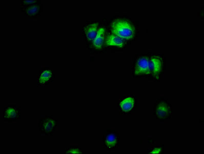 Immunofluorescence staining of MCF-7 cells with the antibody at 1:66, counter-stained with DAPI. The cells were fixed in 4% formaldehyde, permeabilized using 0.2% Triton X-100 and blocked in 10% normal Goat Serum. The cells were then incubated with the antibody overnight at 4°C. The secondary antibody was Alexa Fluor 488-congugated AffiniPure Goat Anti-Rabbit IgG(H+L).Rabbit anti-Human ILK Polyclonal Antibody