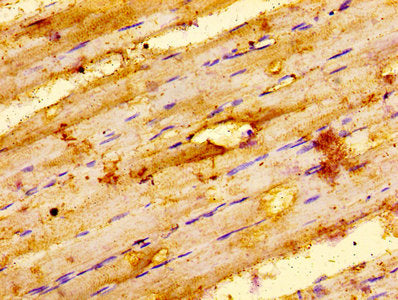 IHC image of ILK Antibody diluted at 1:100 and staining in paraffin-embedded human skeletal muscle tissue performed on a Leica BondTM system. After dewaxing and hydration, antigen retrieval was mediated by high pressure in a citrate buffer (pH 6.0). Section was blocked with 10% normal goat serum 30min at RT. Then primary antibody (1% BSA) was incubated at 4°C overnight. The primary is detected by a biotinylated secondary antibody and visualized using an HRP conjugated SP system.Rabbit anti-Human ILK Polyclonal Antibody