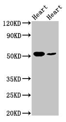 Western Blot  | Positive WB detected in: Rat heart tissue, Mouse heart tissue  | All lanes: ILK antibody at 5µg/ml  | Secondary  | Goat polyclonal to rabbit IgG at 1/50000 dilution  | Predicted band size: 52, 45, 37 kDa  | Observed band size: 52 kDaRabbit anti-Human ILK Polyclonal Antibody