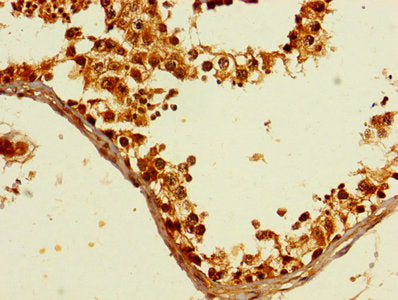 Immunohistochemistry of paraffin-embedded human testis tissue using GTF2B Antibody at dilution of 1:100Rabbit anti-Human GTF2B Polyclonal Antibody