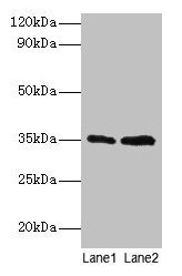 Western blot  | All lanes: GTF2B antibody at 2µg/ml  | Lane 1: HepG2 whole cell lysate  | Lane 2: Hela whole cell lysate  | Secondary  | Goat polyclonal to rabbit IgG at 1/15000 dilution  | Predicted band size: 35 kDa  | Observed band size: 35 kDaRabbit anti-Human GTF2B Polyclonal Antibody