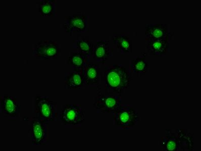 Immunofluorescent analysis of HepG2 cells using GTF2H5 Antibody at dilution of 1:100 and Alexa Fluor 488-congugated AffiniPure Goat Anti-Rabbit IgG(H+L)Rabbit anti-Human GTF2H5 Polyclonal Antibody