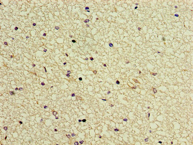 Immunohistochemistry of paraffin-embedded human brain tissue using GTF2H5 Antibody at dilution of 1:100Rabbit anti-Human GTF2H5 Polyclonal Antibody
