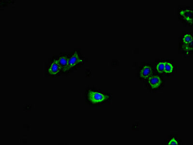 Immunofluorescent analysis of HepG2 cells using GUCY1A1 Antibody at dilution of 1:100 and Alexa Fluor 488-congugated AffiniPure Goat Anti-Rabbit IgG(H+L)Rabbit anti-Human GUCY1A1 Polyclonal Antibody