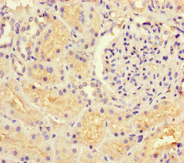 Immunohistochemistry of paraffin-embedded human kidney tissue using the antibody at dilution of 1:100Rabbit anti-Human GUCY1A1 Polyclonal Antibody