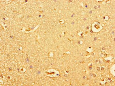 Immunohistochemistry of paraffin-embedded human brain tissue using the antibody at dilution of 1:100Rabbit anti-Human GUCY2C Polyclonal Antibody