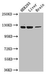 Western Blot | Positive WB detected in: HEK293 whole cell lysate, Mouse liver tissue, Mouse brain tissue | All lanes: GUCY2C antibody at 3.4μg/ml | Secondary | Goat polyclonal to rabbit IgG at 1/50000 dilution | Predicted band size: 124 kDa | Observed band size: 124 kDaRabbit anti-Human GUCY2C Polyclonal Antibody