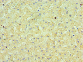 Immunohistochemistry of paraffin-embedded human liver tissue using GUSB Antibody at dilution of 1:100Rabbit anti-Human GUSB Polyclonal Antibody