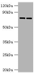Western blot | All lanes: AGUSB antibody at 2μg/ml | Lane 1: HL60 whole cell lysate | Lane 2: HepG2 whole cell lysate | Secondary | Goat polyclonal to rabbit IgG at 1/10000 dilution | Predicted band size: 75, 70, 59 kDa | Observed band size: 75 kDaRabbit anti-Human GUSB Polyclonal Antibody