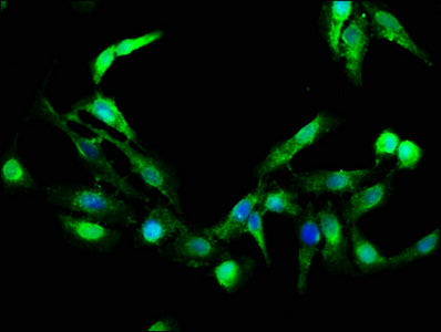 Immunofluorescence staining of Hela cells with GZMB Antibody at 1:266, counter-stained with DAPI. The cells were fixed in 4% formaldehyde, permeabilized using 0.2% Triton X-100 and blocked in 10% normal Goat Serum. The cells were then incubated with the antibody overnight at 4°C. The secondary antibody was Alexa Fluor 488-congugated AffiniPure Goat Anti-Rabbit IgG(H+L).Rabbit anti-Human GZMB Polyclonal Antibody
