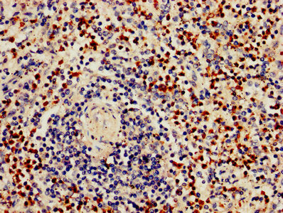 IHC image of GZMB Antibody diluted at 1:800 and staining in paraffin-embedded human spleen tissue performed on a Leica BondTM system. After dewaxing and hydration, antigen retrieval was mediated by high pressure in a citrate buffer (pH 6.0). Section was blocked with 10% normal goat serum 30min at RT. Then primary antibody (1% BSA) was incubated at 4°C overnight. The primary is detected by a biotinylated secondary antibody and visualized using an HRP conjugated SP system.Rabbit anti-Human GZMB Polyclonal Antibody