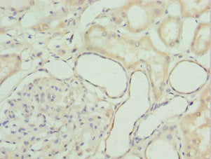 Immunohistochemistry of paraffin-embedded human kidney tissue using the antibody at dilution of 1:100Rabbit anti-Human GZMH Polyclonal Antibody