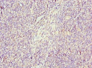 Immunohistochemistry of paraffin-embedded human thymus tissue using GZMH Antibody at dilution of 1:100Rabbit anti-Human GZMH Polyclonal Antibody