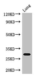 Western Blot | Positive WB detected in: Mouse lung tissue | All lanes: PSMB5 antibody at 3μg/ml | Secondary | Goat polyclonal to rabbit IgG at 1/50000 dilution | Predicted band size: 29, 22, 18 kDa | Observed band size: 29 kDaRabbit anti-Human PSMB5 Polyclonal Antibody