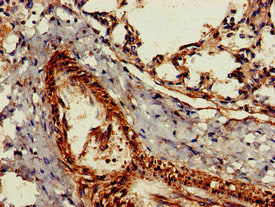 Immunohistochemistry of paraffin-embedded human lung tissue using the antibody at dilution of 1:100Rabbit anti-Human GZMK Polyclonal Antibody